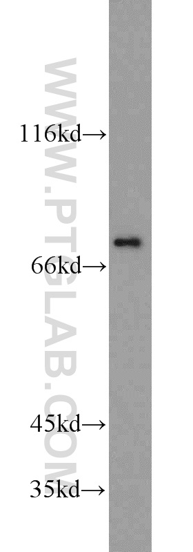 18131-1-AP;Jurkat cells