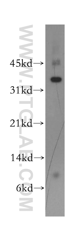 13254-1-AP;SH-SY5Y cells