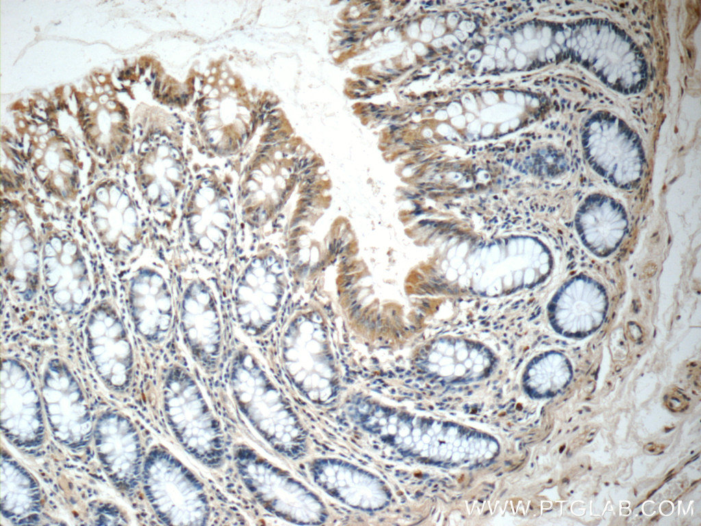 24725-1-AP;human colon tissue