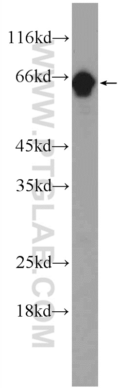 24725-1-AP;human testis tissue