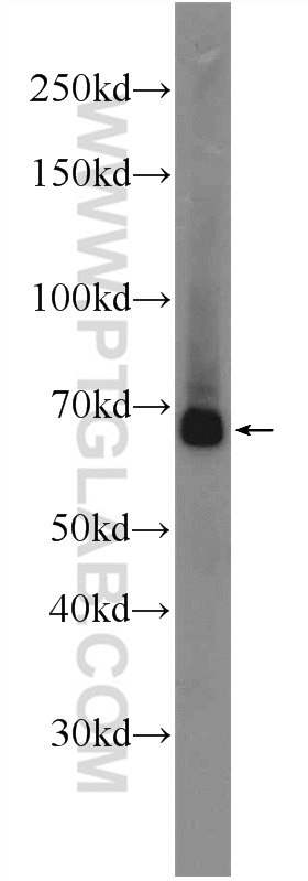 24725-1-AP;HeLa cells