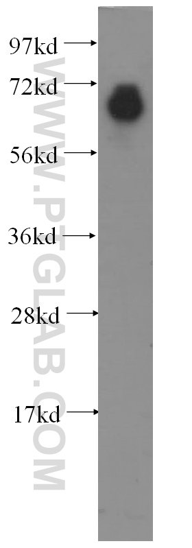 11827-1-AP;human ileum tissue