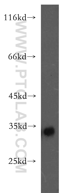 11028-2-AP;K-562 cells