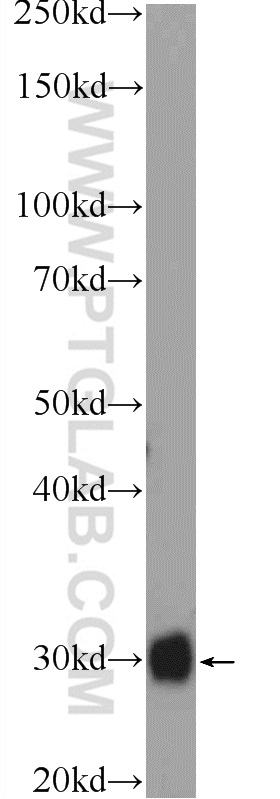 12650-2-AP;mouse heart tissue