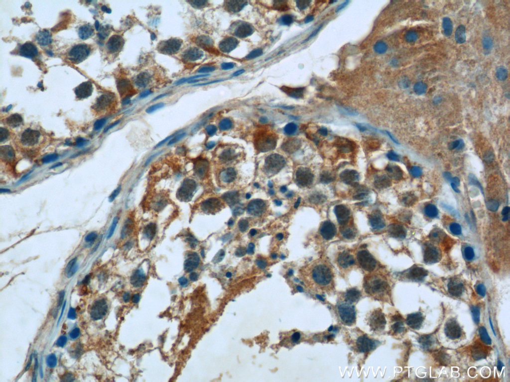 17417-1-AP;human testis tissue