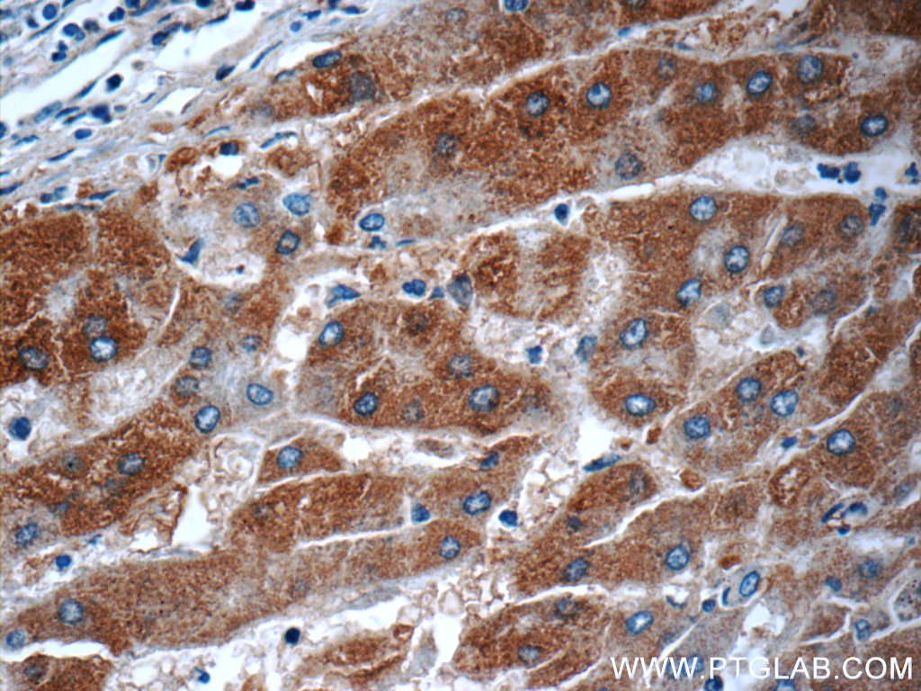 17417-1-AP;human hepatocirrhosis tissue