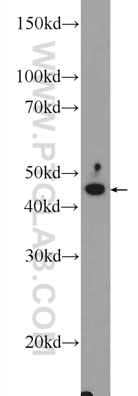 17417-1-AP;fetal human brain tissue