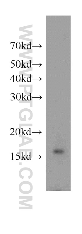 11700-1-AP;mouse cerebellum tissue