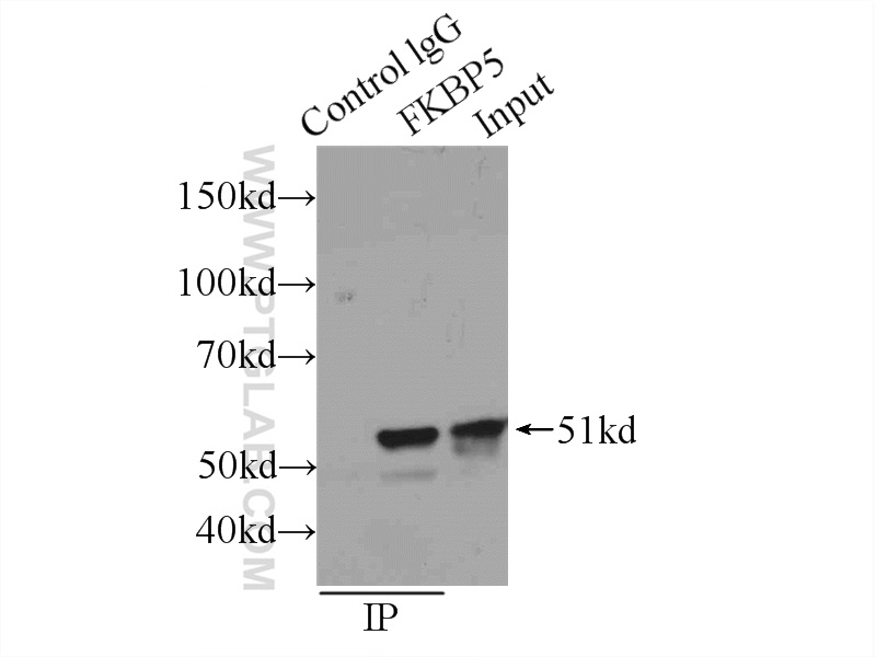 14155-1-AP;K-562 cells