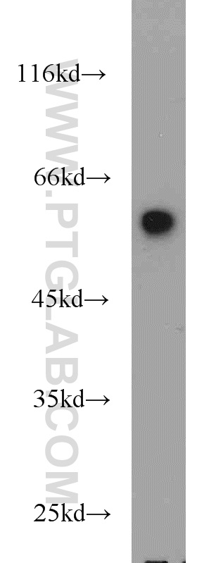 10655-1-AP;HeLa cells