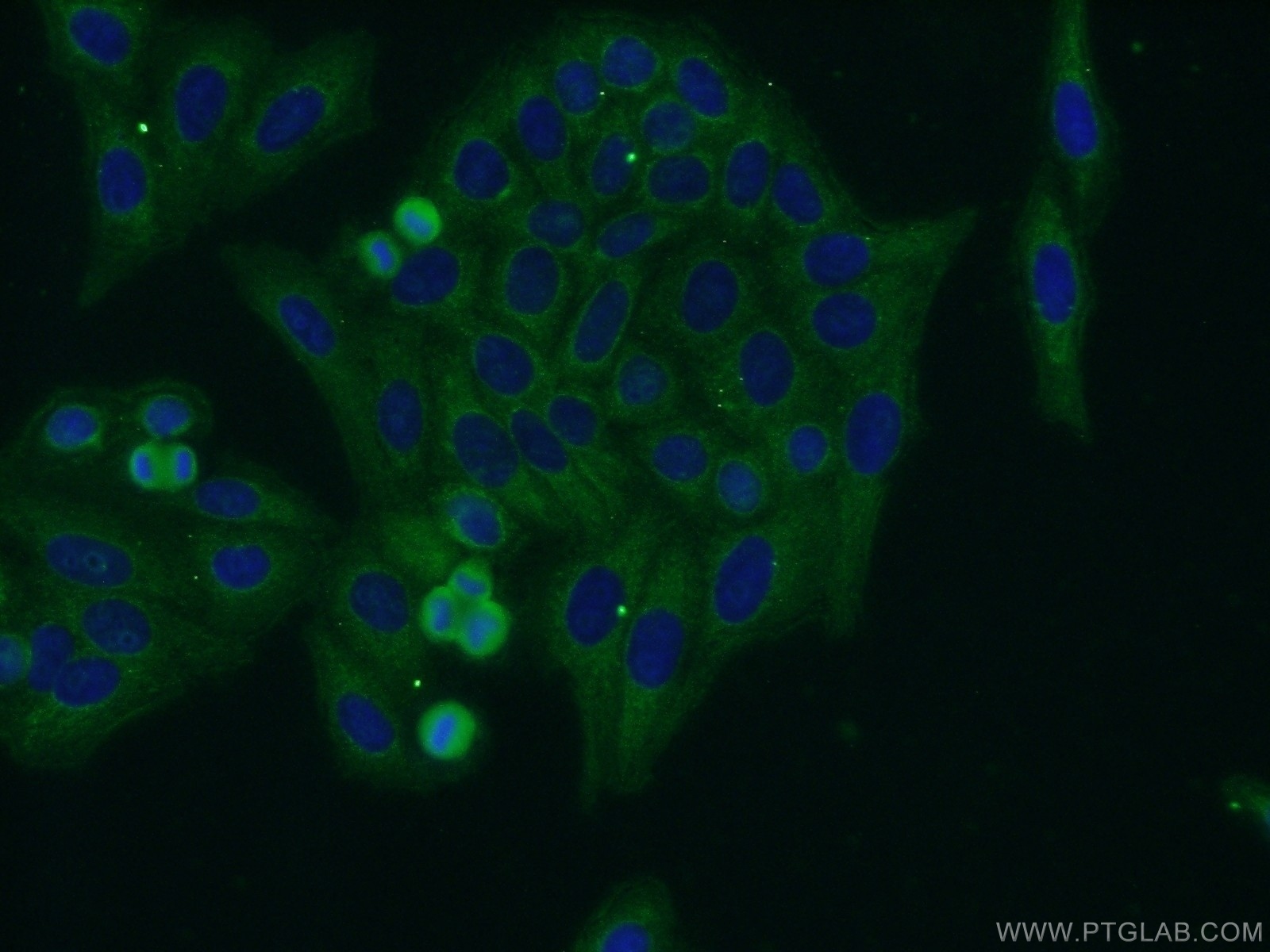 14118-1-AP;HepG2 cells