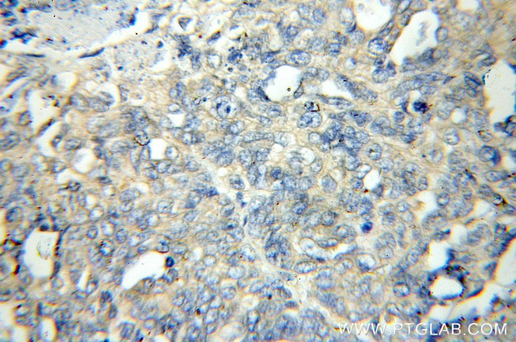 11236-2-AP;human ovary tumor