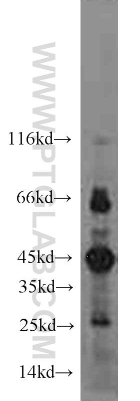 11236-2-AP;mouse thymus tissue