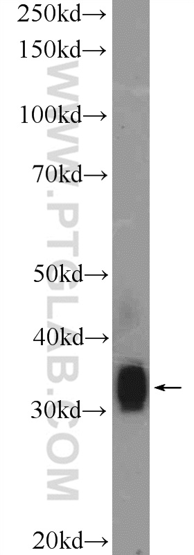 26103-1-AP;mouse liver tissue