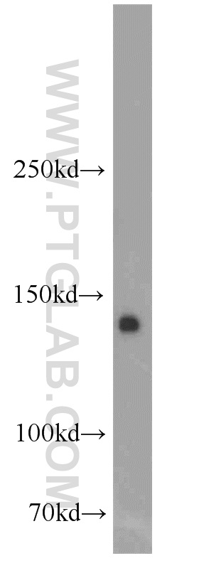 21049-1-AP;mouse brain tissue