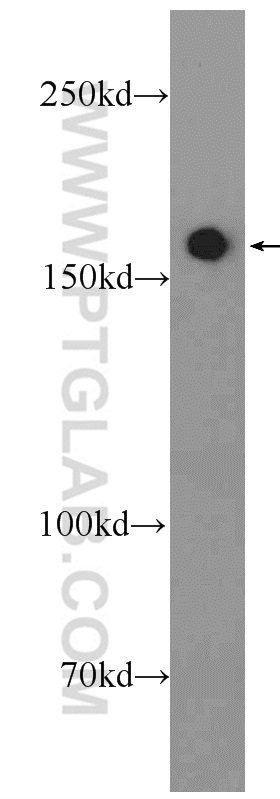 25982-1-AP;A549 cells