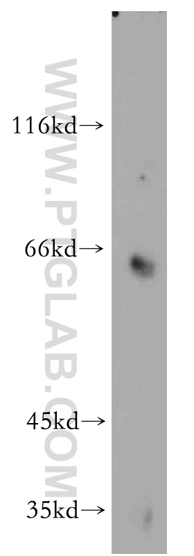 55055-1-AP;mouse brain tissue