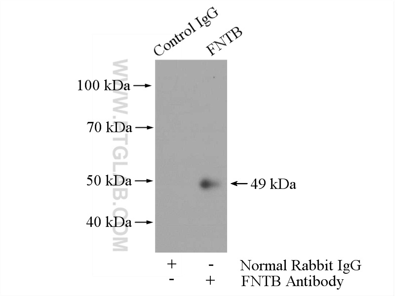 11507-1-AP;HeLa cells