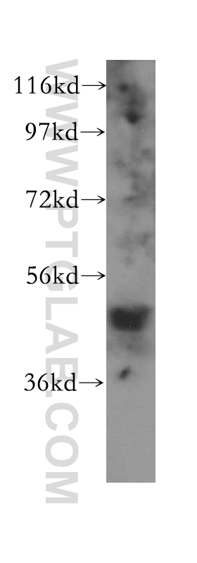 11507-1-AP;HeLa cell