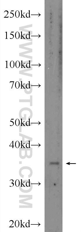 24285-1-AP;HepG2 cells