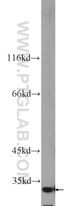 24285-1-AP;mouse liver tissue