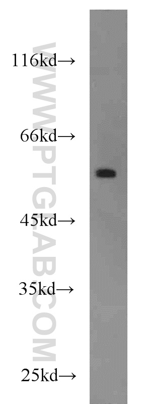 23066-1-AP;A375 cells