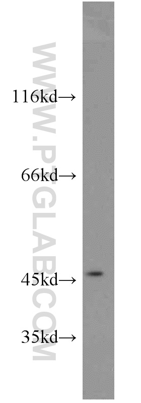 19121-1-AP;human heart tissue