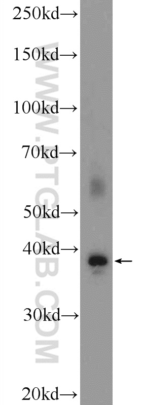 21942-1-AP;fetal human brain tissue