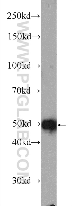 24595-1-AP;HeLa cells