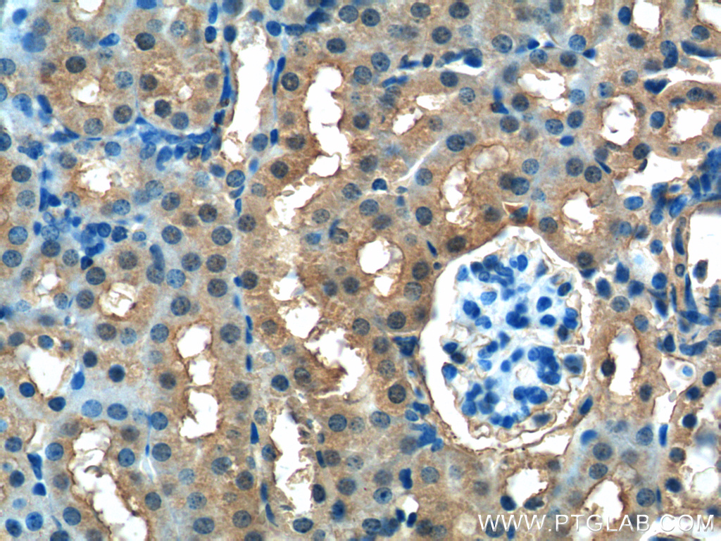 13541-1-AP;mouse kidney tissue