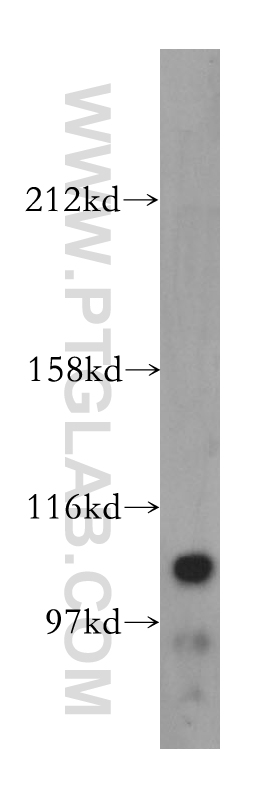 13541-1-AP;mouse kidney tissue