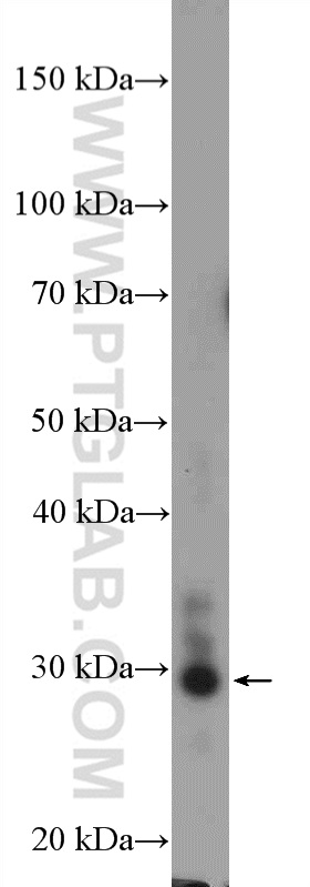 10131-1-AP;HepG2 cells