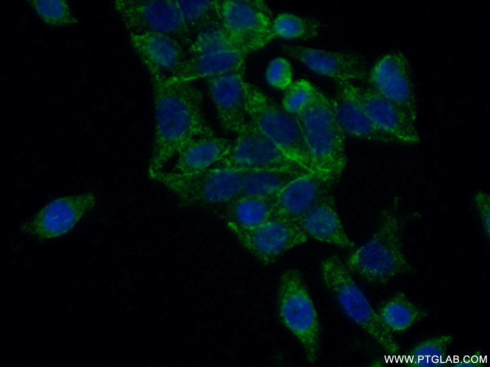 16567-1-AP;HeLa cells