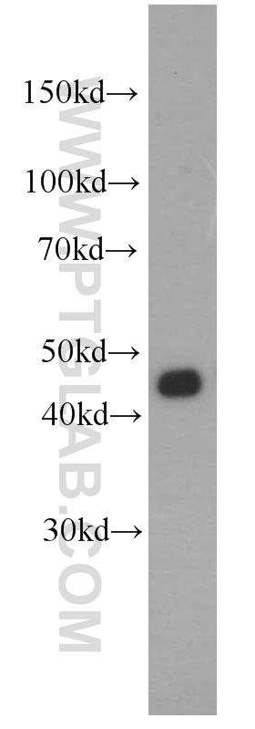 16567-1-AP;HeLa cells