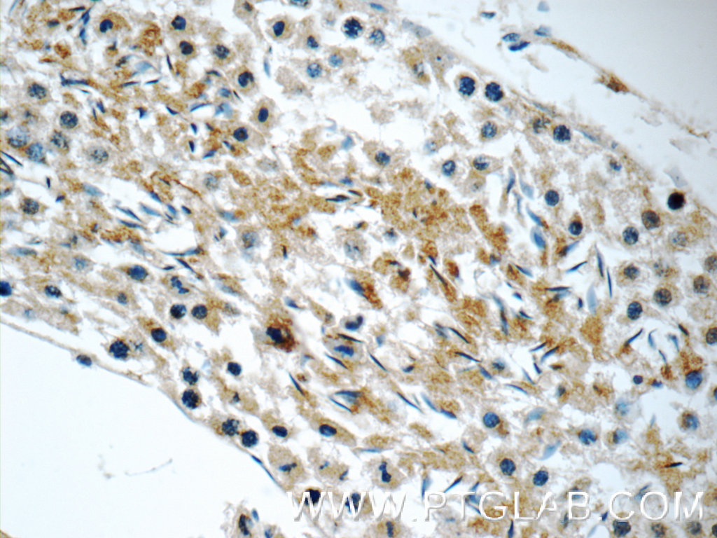 11966-1-AP;mouse testis tissue