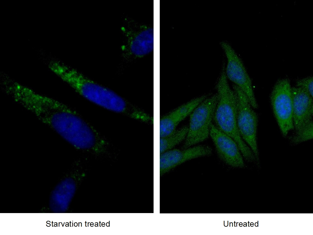 18723-1-AP;Starvation treated HepG2 cells