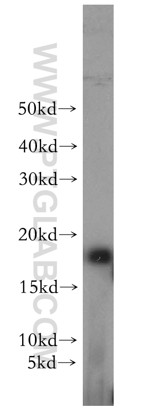 18721-1-AP;mouse kidney tissue