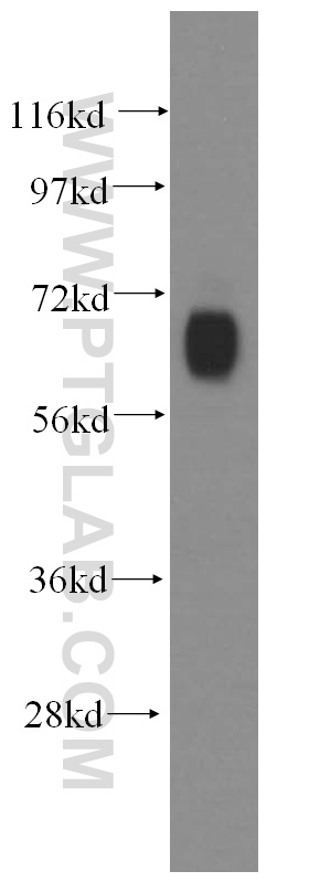 15623-1-AP;human brain tissue