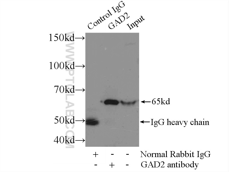 21760-1-AP;rat brain tissue