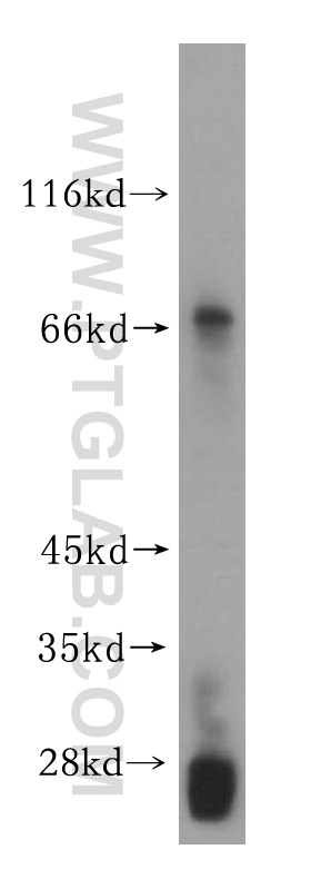 16900-1-AP;HEK-293 cells