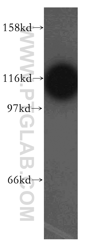 13659-1-AP;HepG2 cell