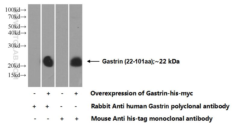 18143-1-AP;Transfected HEK-293 cells