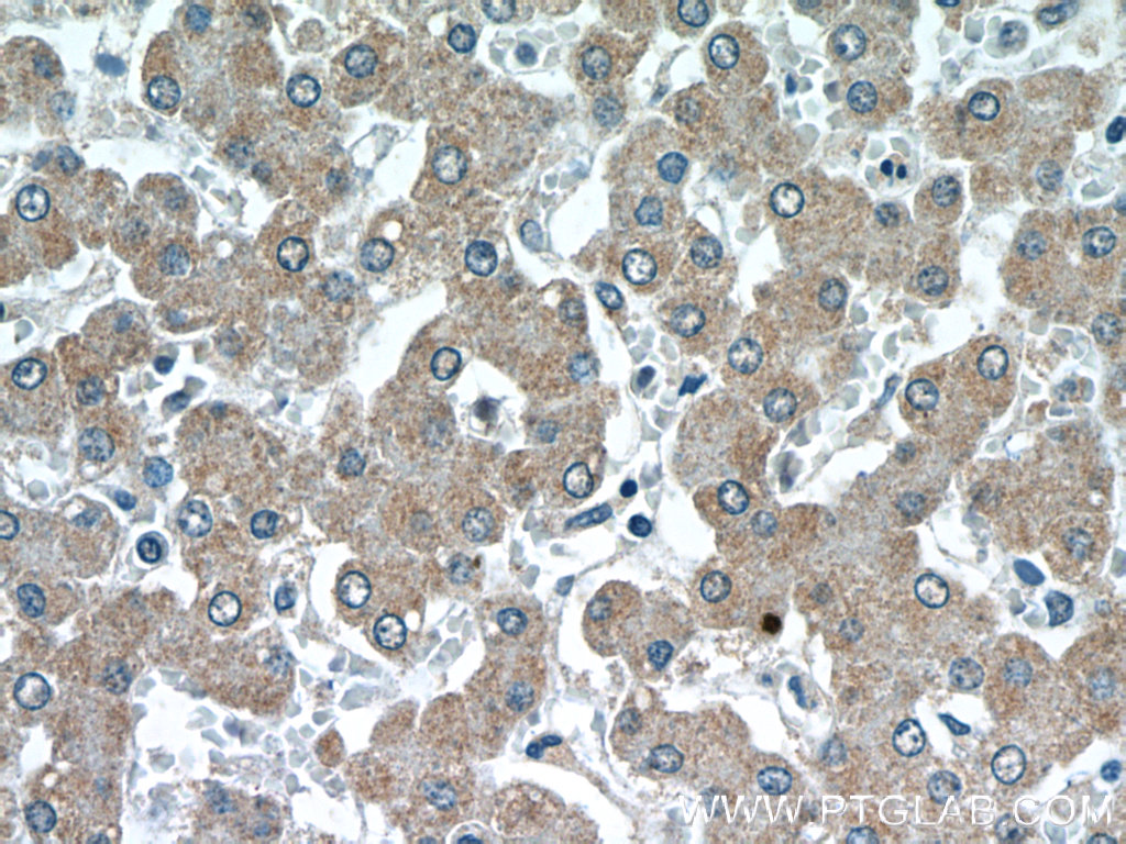 23183-1-AP;human liver tissue