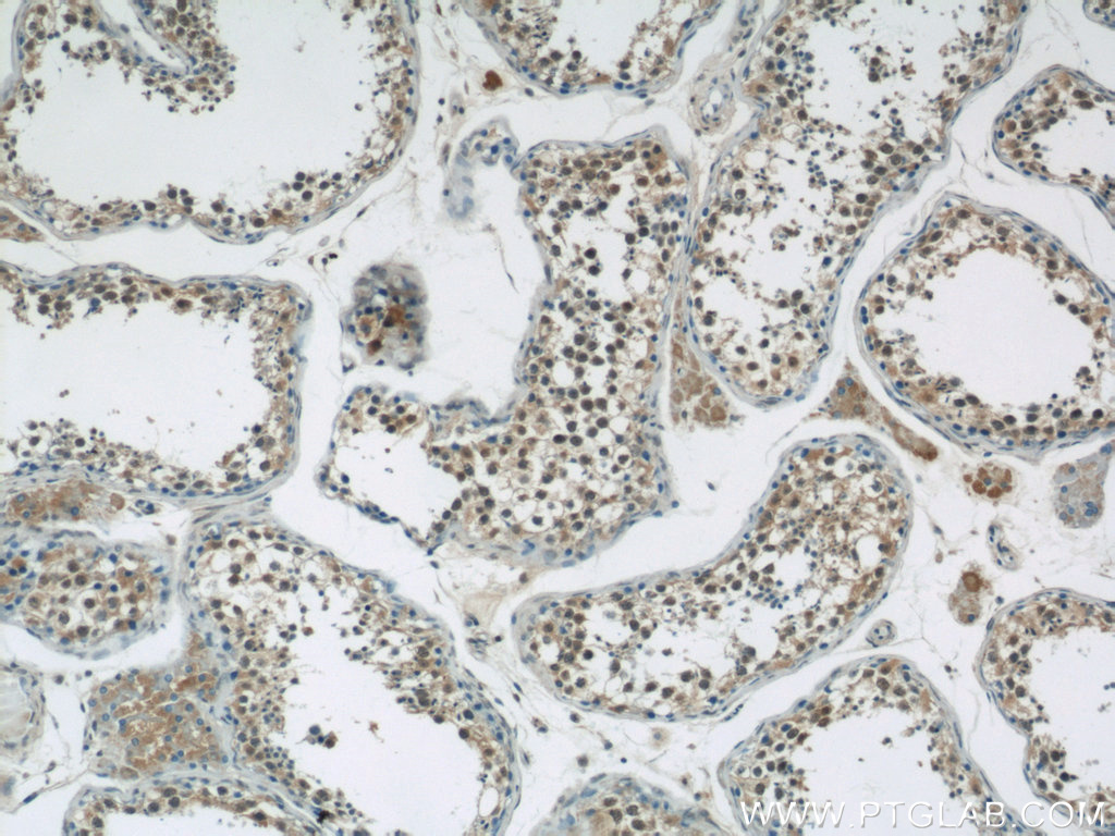 23001-1-AP;human testis tissue