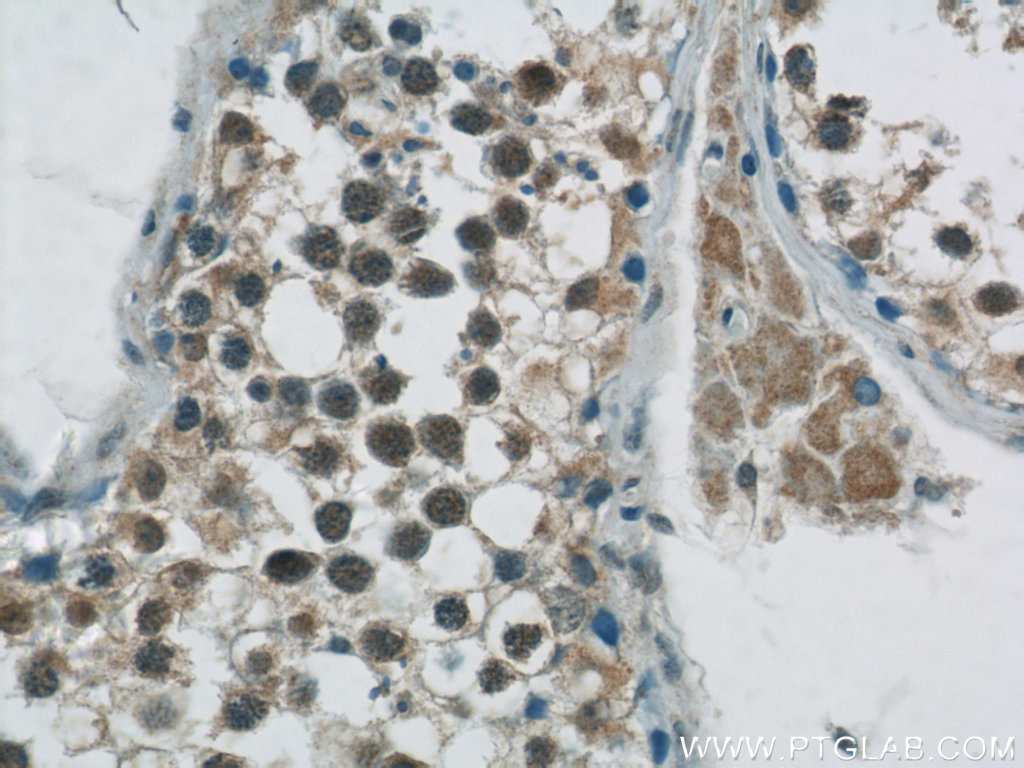 23001-1-AP;human testis tissue