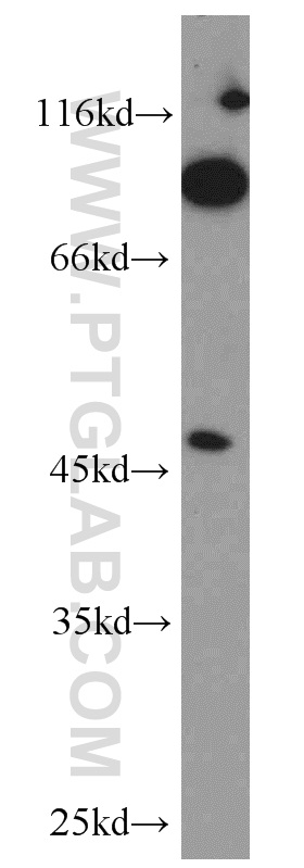 18118-1-AP;mouse kidney tissue