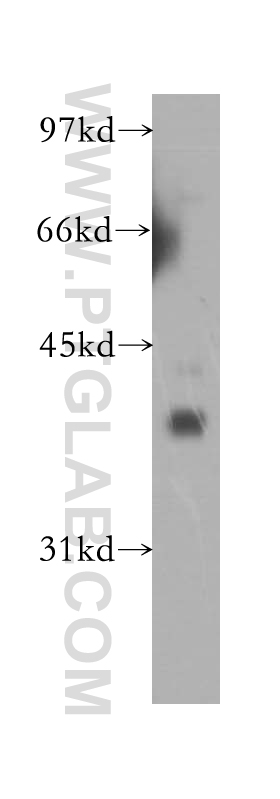 13152-1-AP;human brain tissue