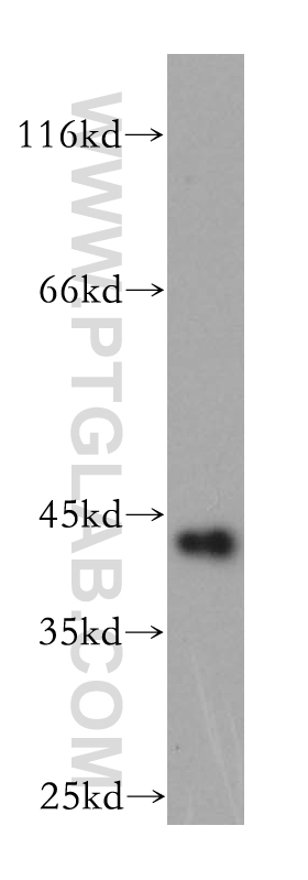 11977-1-AP;Y79 cell