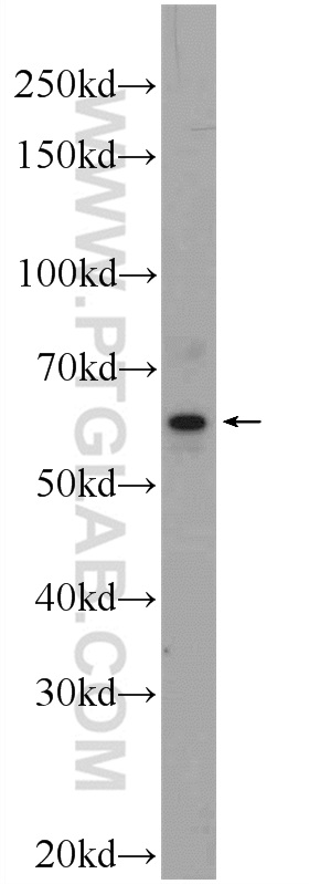 17246-1-AP;Raji cells