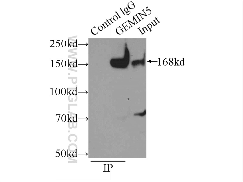 24897-1-AP;HeLa cells